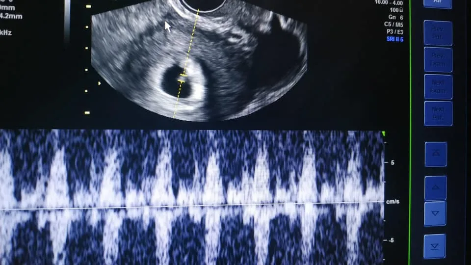 Embryon Fertility Center | IVF Clinic Cyprus — photo 3