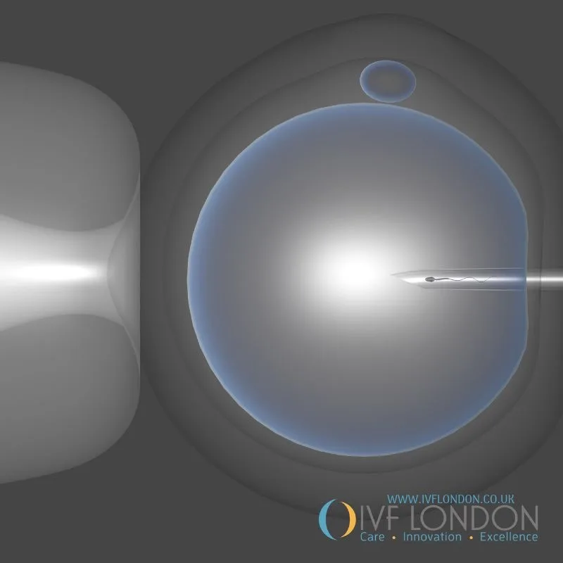 IVF London — photo 2