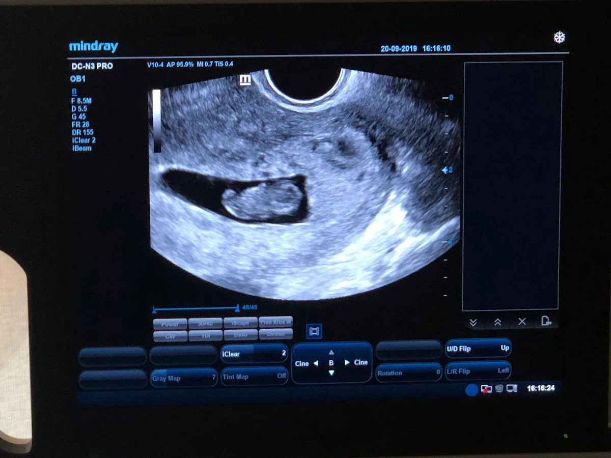 Clínica EVA Fertilidad y Reproducción Asistida