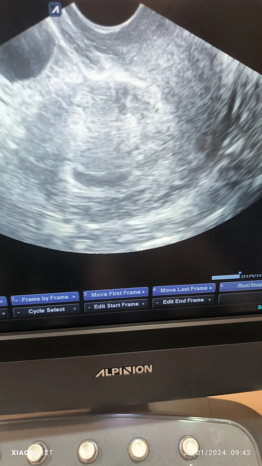 Dr. dr. Adek Amansyah, M.Biomed, Sp.O.G, Subsp.F.E.R | Spesialis Kebidanan - Subspesialis Fertilitas Endokrinologi Reproduksi — photo 3