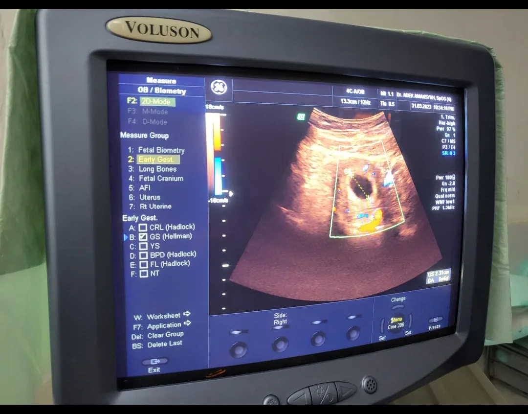 Dr. dr. Adek Amansyah, M.Biomed, Sp.O.G, Subsp.F.E.R | Spesialis Kebidanan - Subspesialis Fertilitas Endokrinologi Reproduksi — photo 4