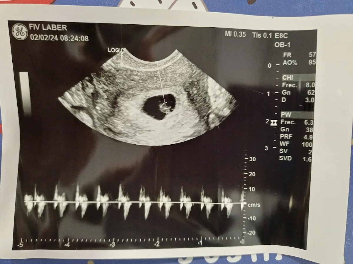 Fivlaber — photo 5