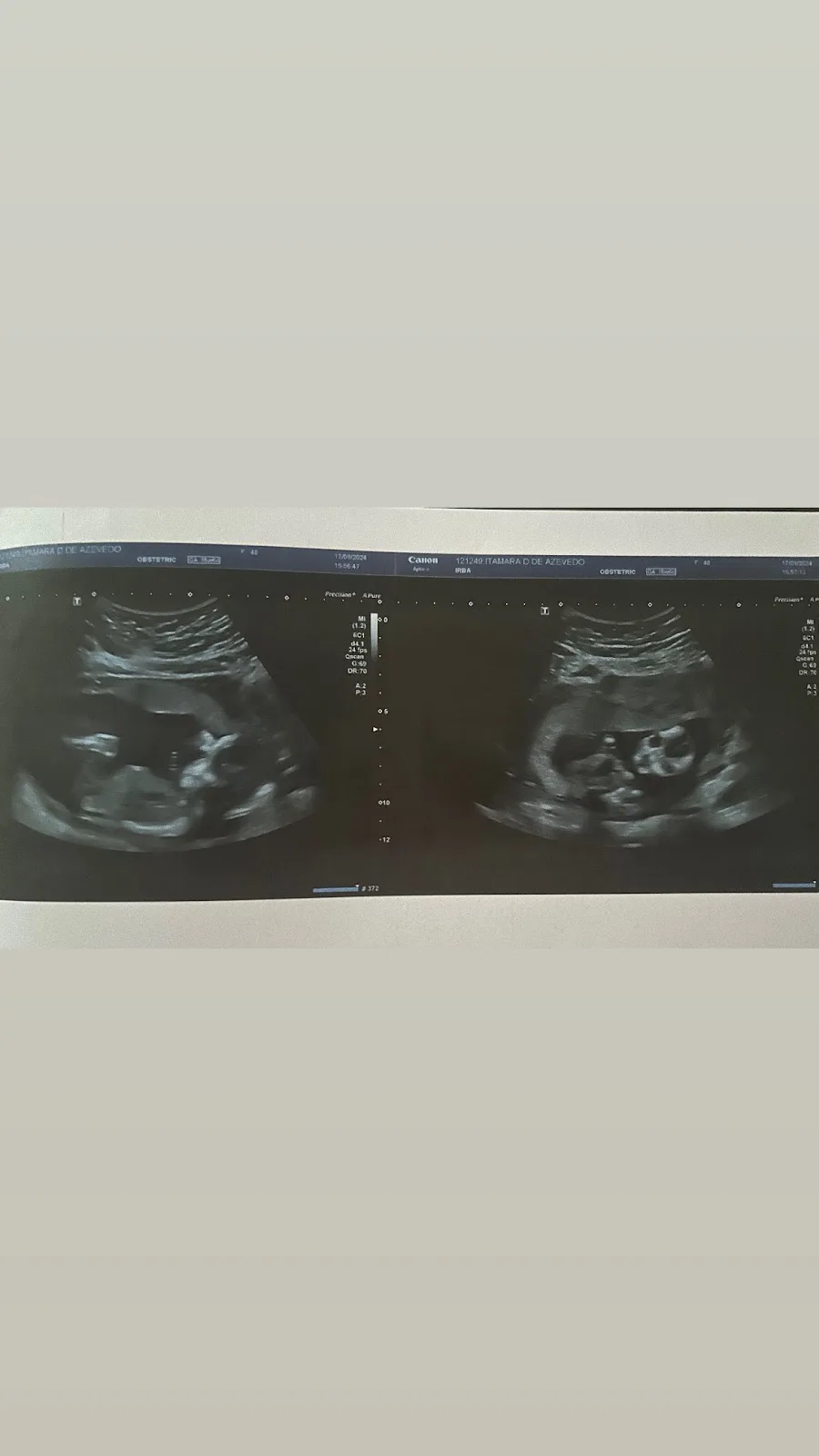 IVI Salvador - Clinica de Reprodução Humana — photo 4