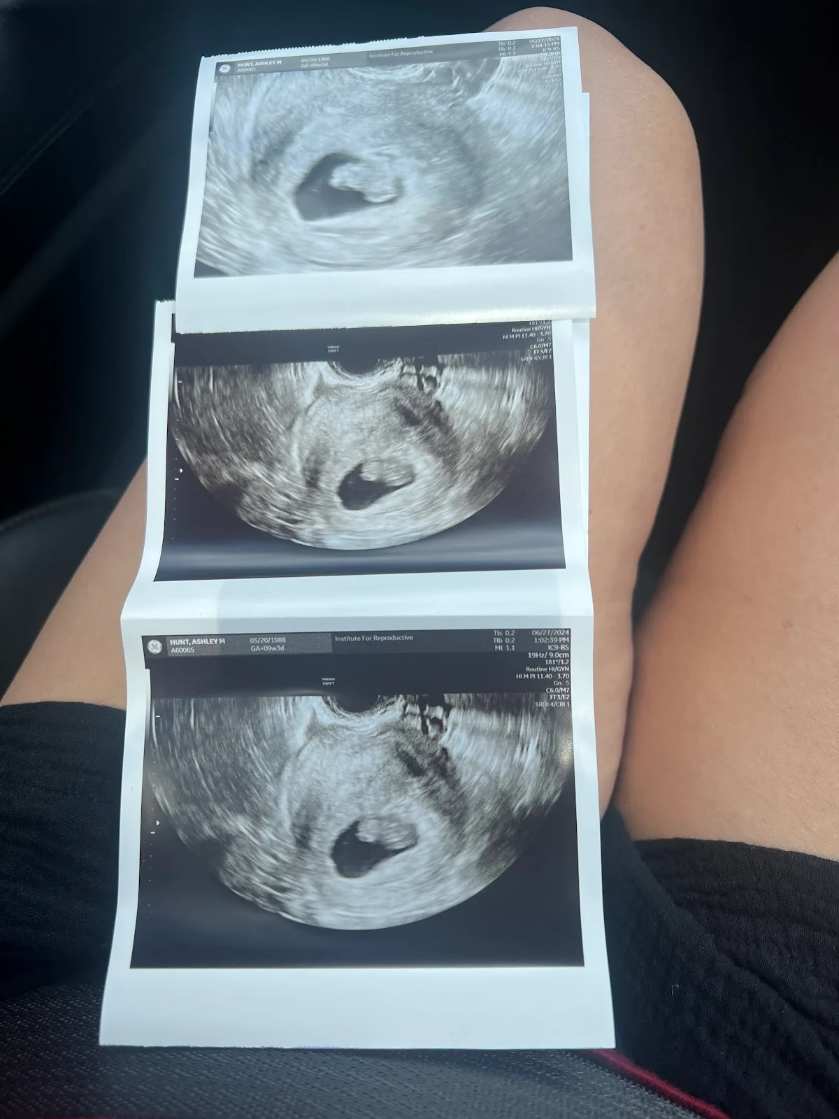 Institute for Reproductive Health | Cincinnati Fertility — photo 2