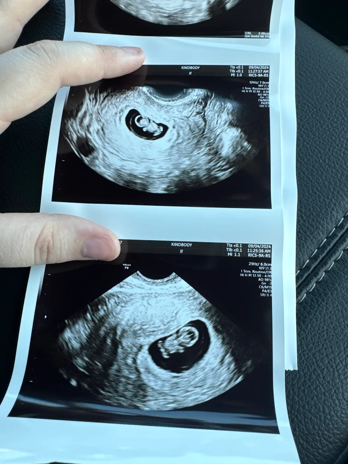 Kindbody - Columbus — photo 5