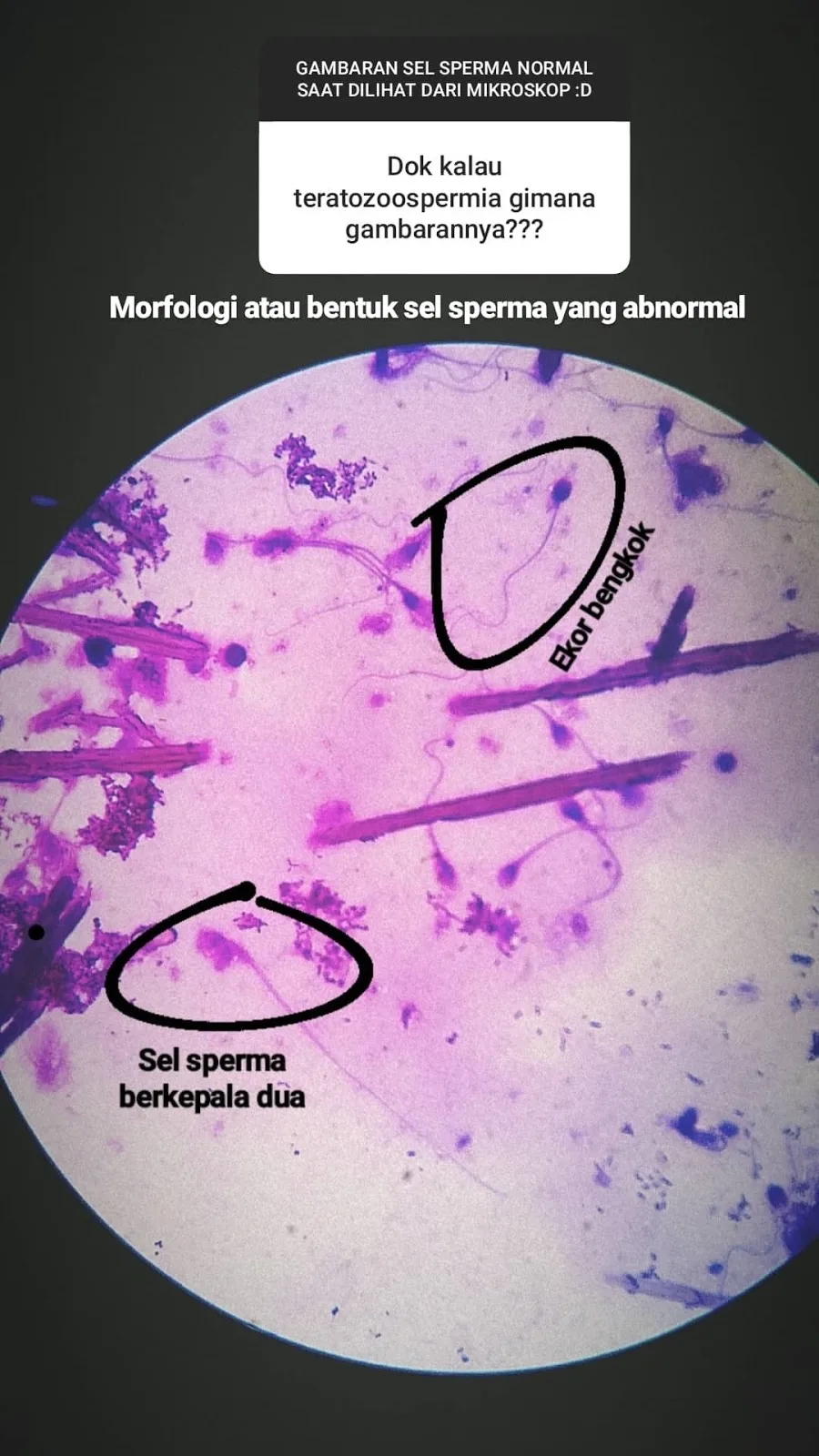 Klinik Fertilitas &amp; Bayi Tabung Tiara Cita