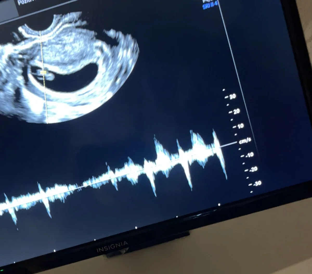 Pozitivf Fertility — photo 4