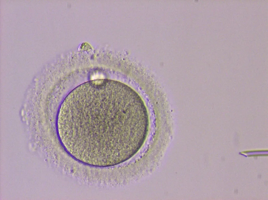 Praxis-Klinik Dr. med. Swetlana Hoffmann, Dr. med. Ulrike Bergmann-Hensel, Dr. med. Dagmar Geiß, FÄ für Reproduktionsmedizin — photo 5