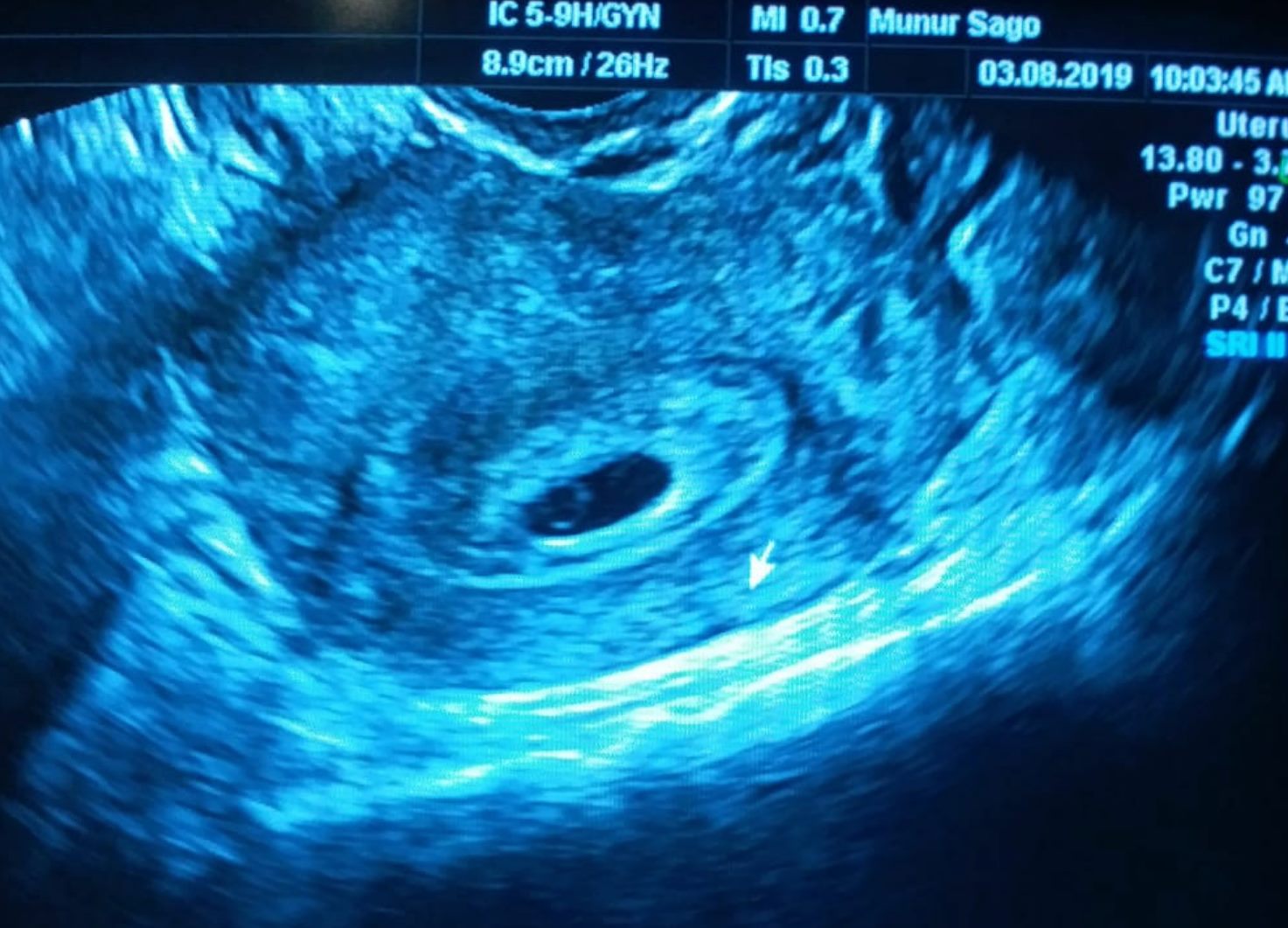 Sago IVF Team - Dr. Münür Şago — photo 3