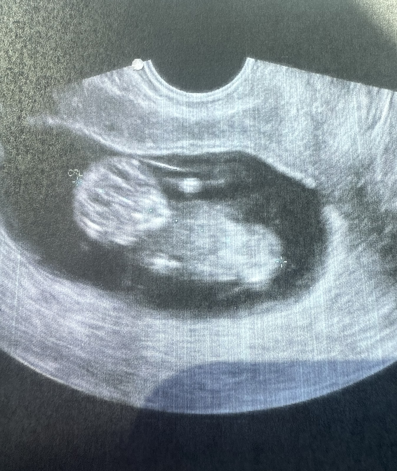 CARE Fertility — photo 5