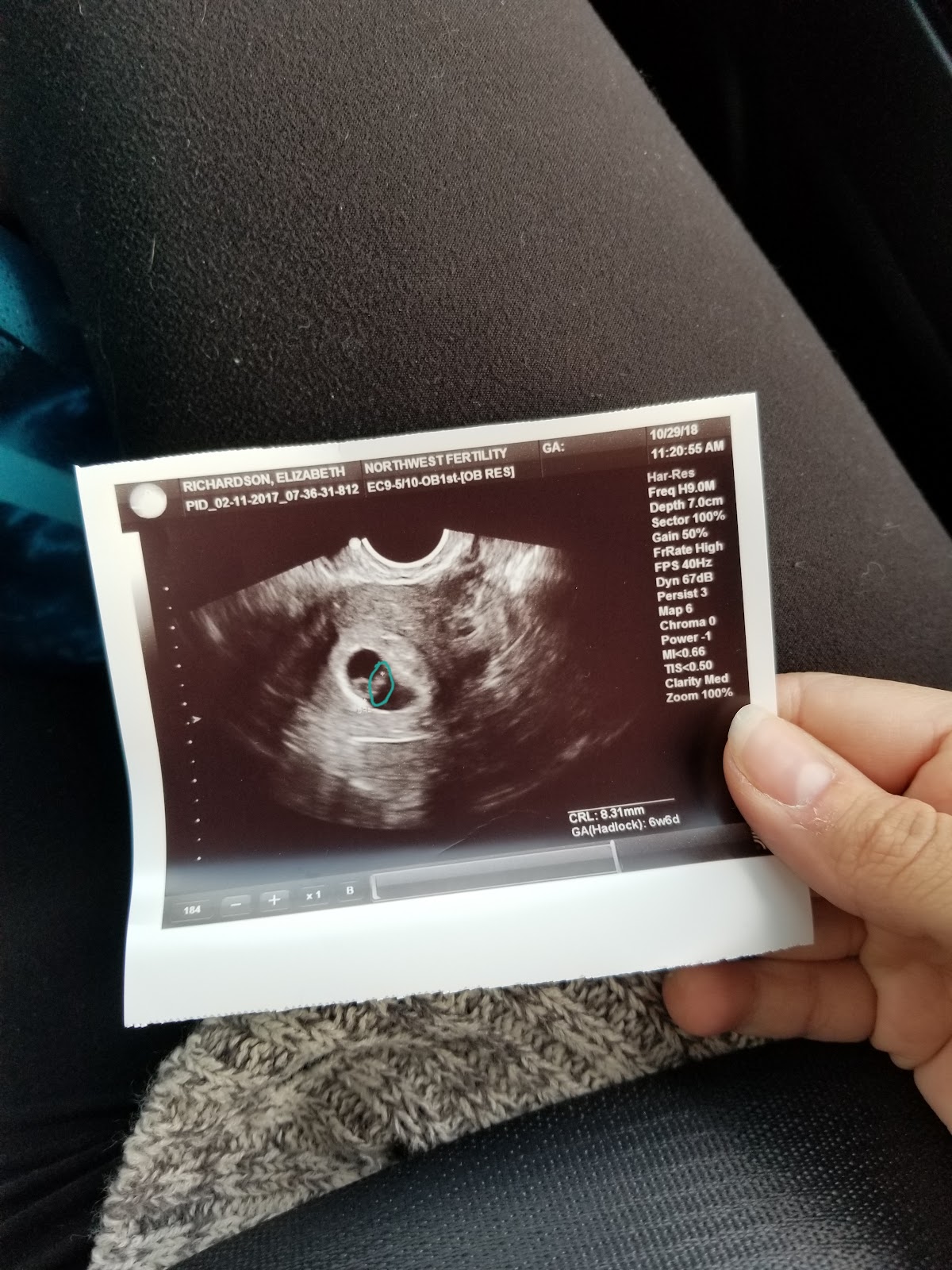 Northwest Fertility Center — photo 3