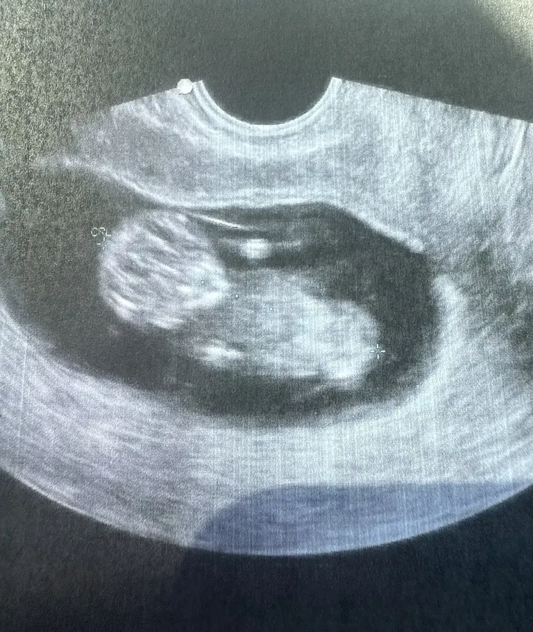 CARE Fertility — photo 5