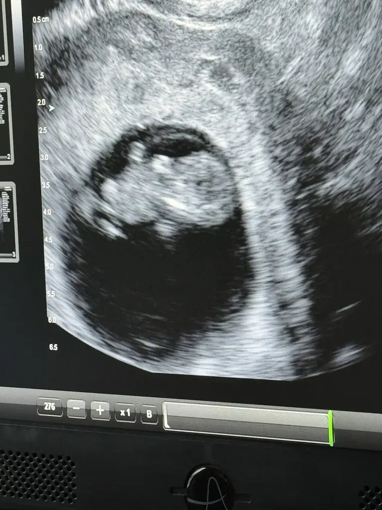 Aspire Houston Fertility Institute