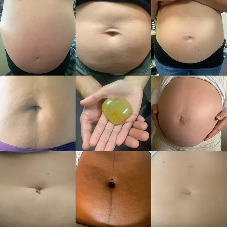 Acupuncture Fertility Specialists — photo 2
