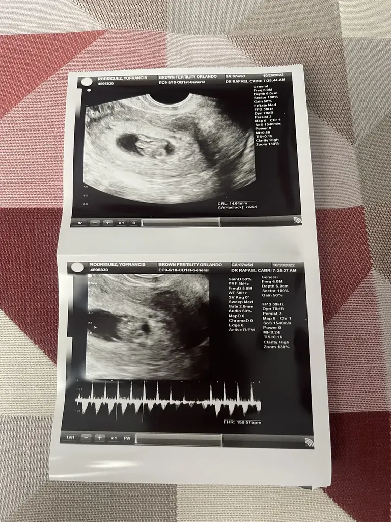 Brown Fertility